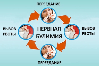 Лечение булимии в Уржуме